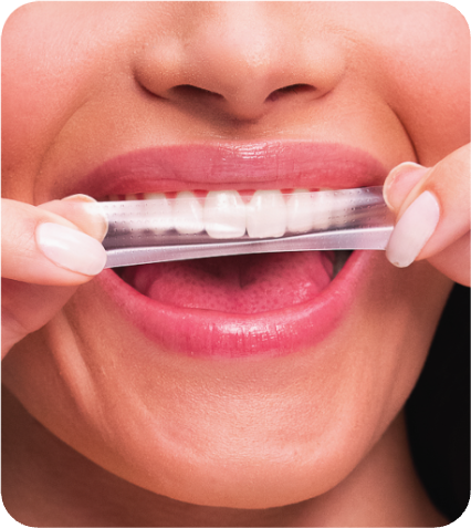 Fitas Clareadoras Dentais