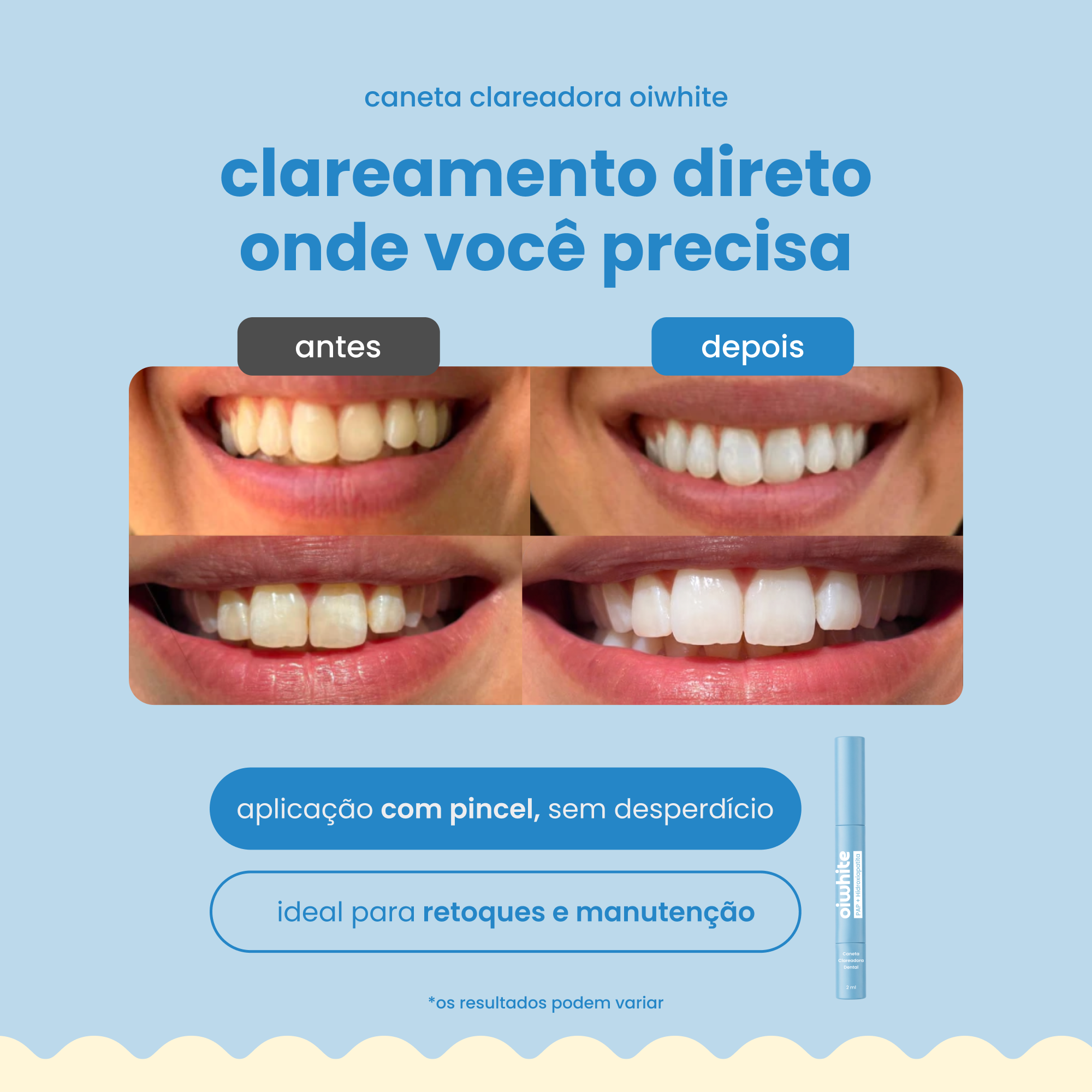 Caneta Clareadora Dental