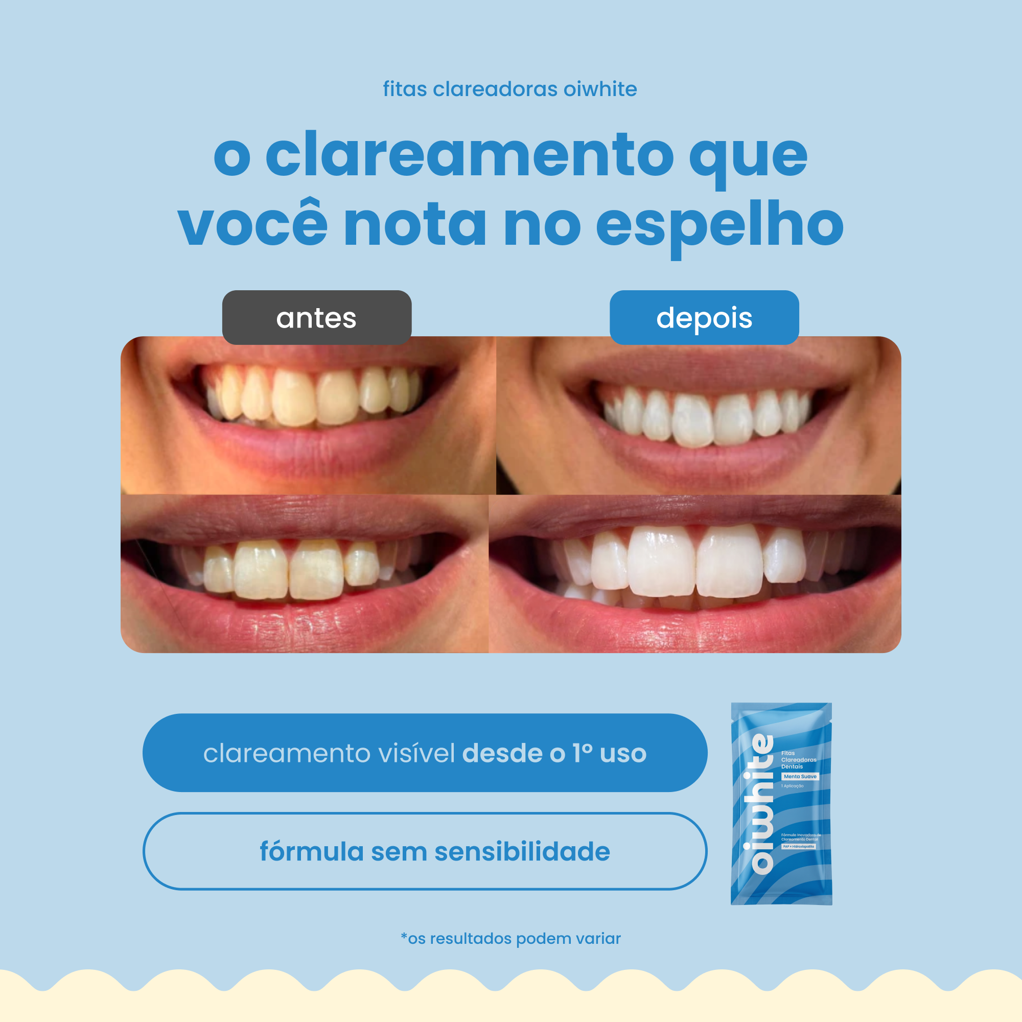 Fitas Clareadoras Dentais