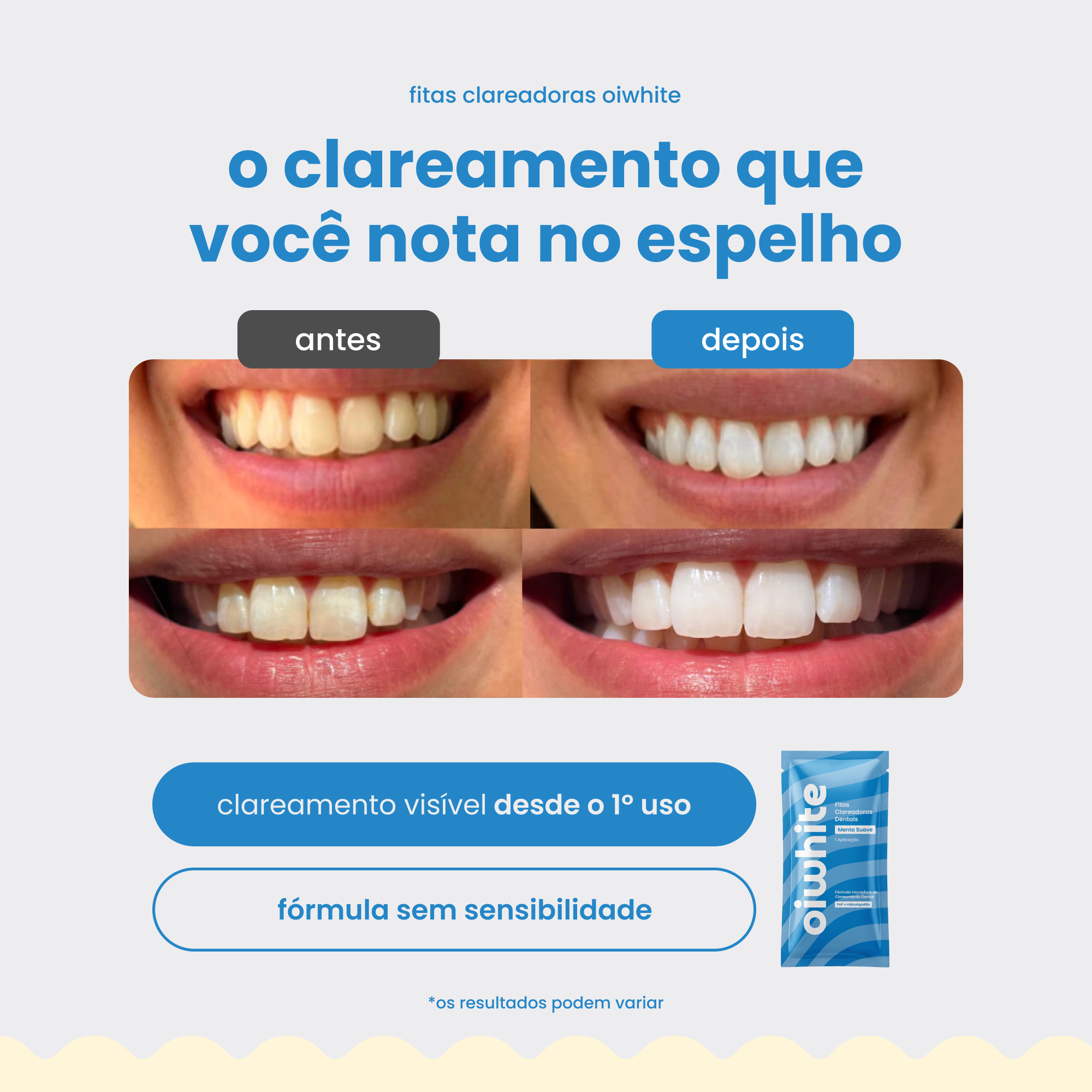 Fitas Clareadoras Dentais