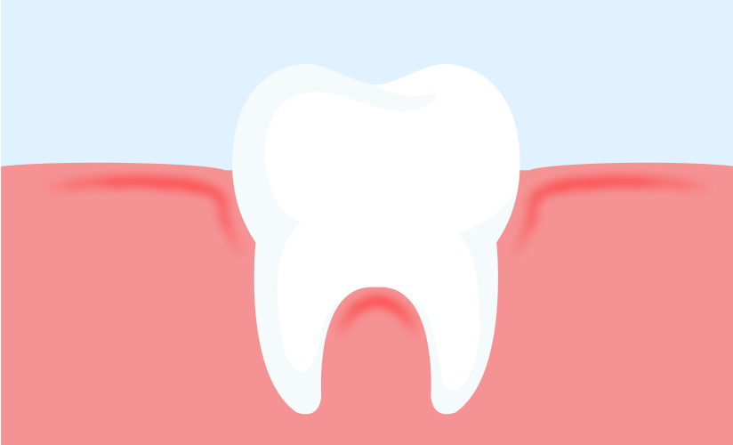 Tooth Clean