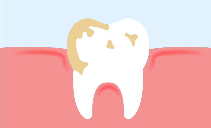 Tooth Dirty
