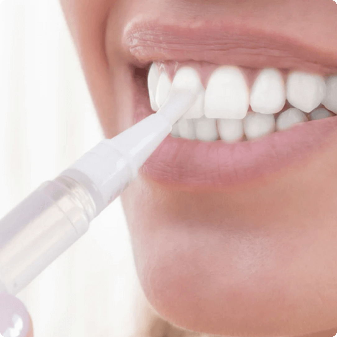 quanto custa uma caneta de clareamento dental 